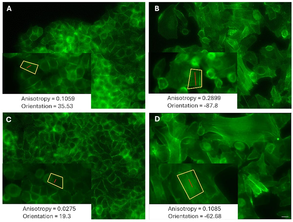 Рисунок. Типичное изображение актиновых волокон, окрашенных фаллоидином, клеток LM (A, C) MCF7 и HM (B, D) MDA-MB-231 во время появления. (A, B) Лидерные клетки. (C, D) Периферические клетки. Источник: Life